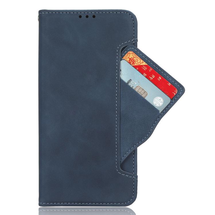 For Ulefone Note 20 Pro Skin Feel Calf Texture Card Slots Leather Phone Case(Blue) - Ulefone Cases by PMC TechLife | Online Shopping South Africa | PMC TechLife | Buy Now Pay Later Mobicred