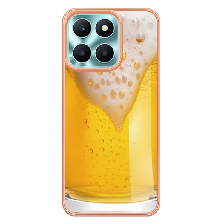 For Honor X6a Electroplating Marble Dual-side IMD Phone Case(Draft Beer) - Honor Cases by PMC Jewellery | Online Shopping South Africa | PMC Jewellery | Buy Now Pay Later Mobicred