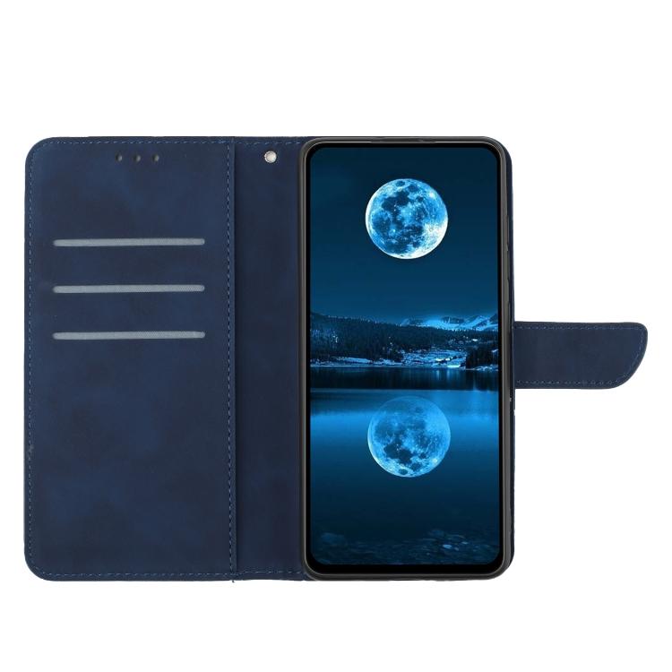 For Tecno Spark 40 Pro+ 4G Stitching Embossed Leather Phone Case(Blue) - free shipping - PMC TechLife - Order now!