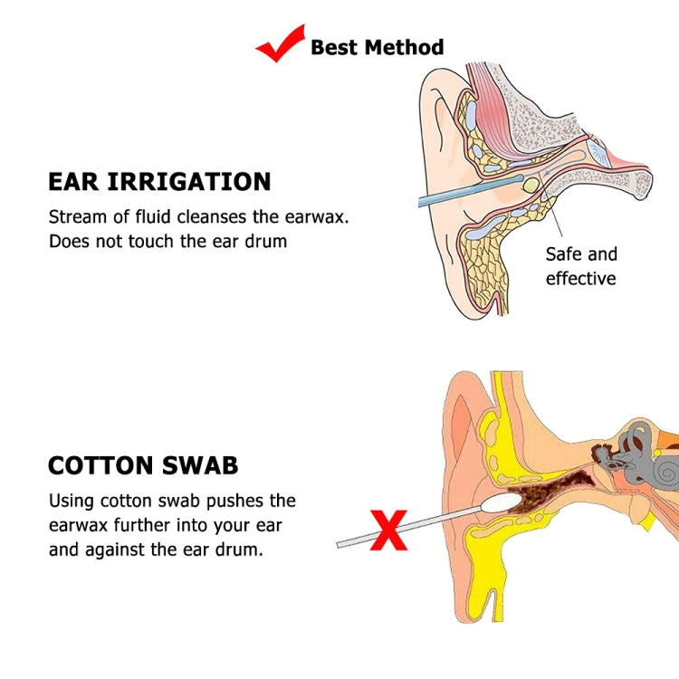 Ear Wash Ball Ear Wash Set Ear Wax Cleaning Tool - Ear Care Tools by PMC TechLife | Online Shopping South Africa | PMC TechLife